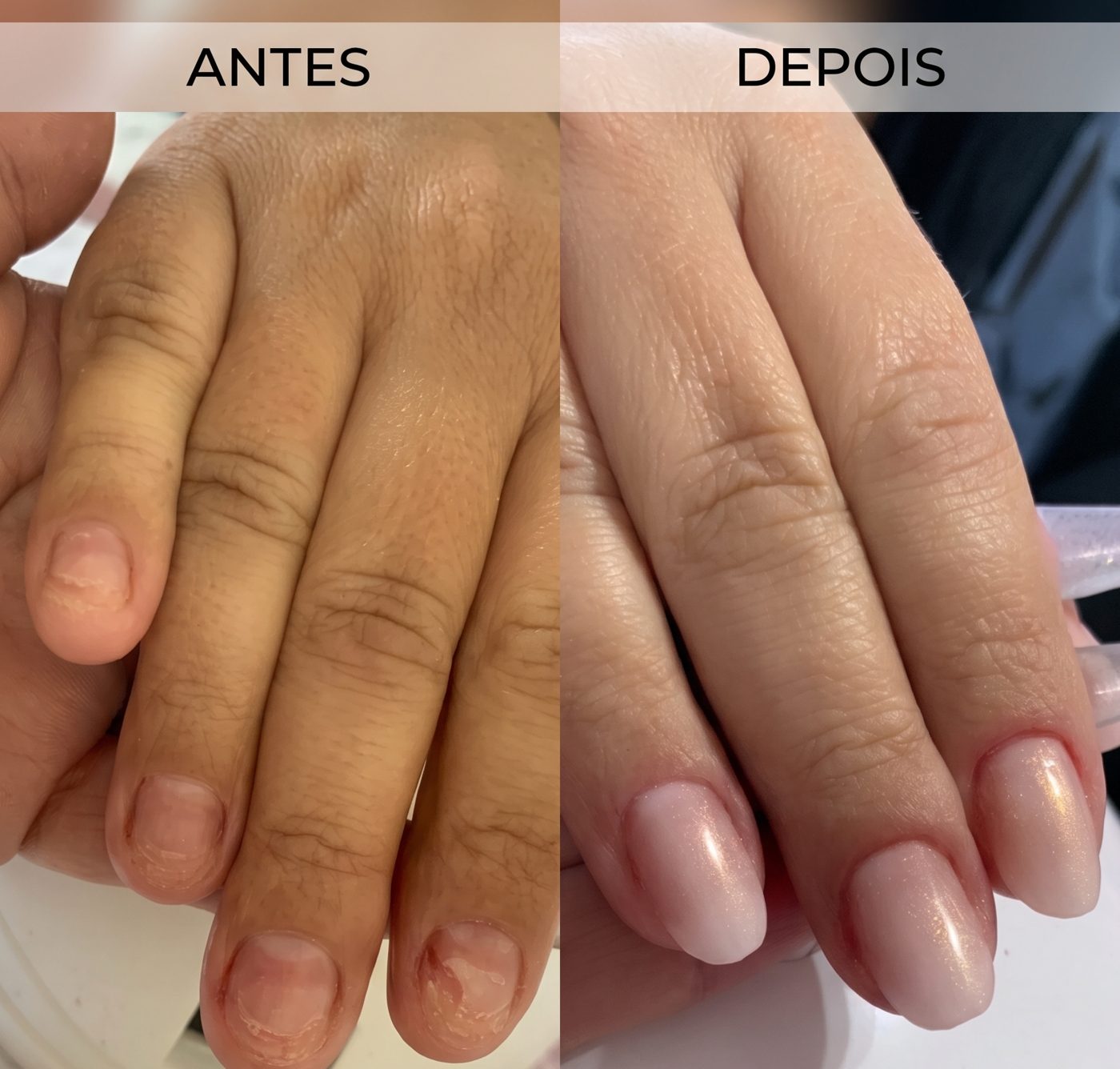 Antes e depois: Antes e depois